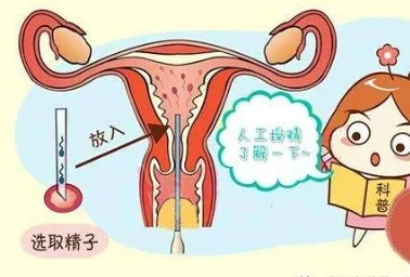 人工授精OR试管婴儿，你该PICK哪一个？