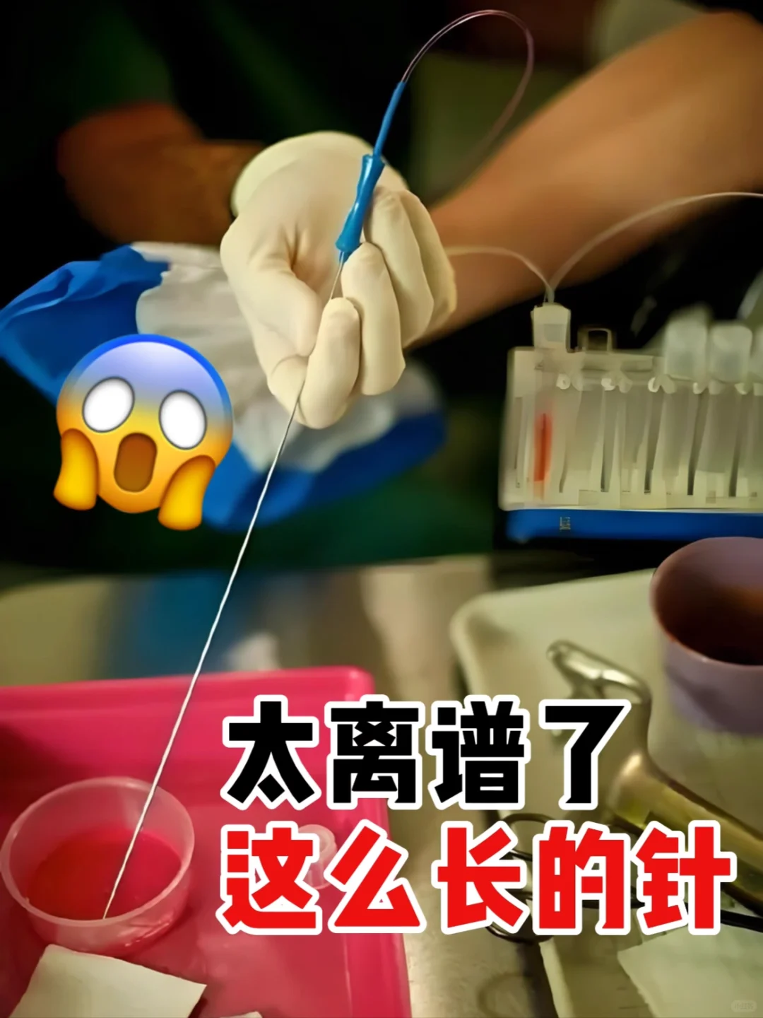 取卵到底痛不痛,代孕网电话