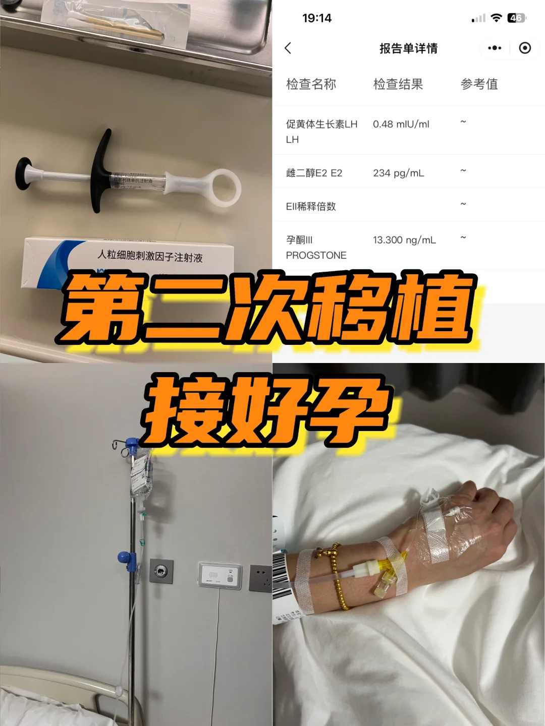 第二次囊胚移植，接好孕！加油！