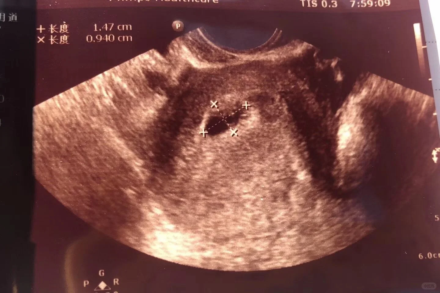 做试管期间，夫妇吃什么好？别迷信