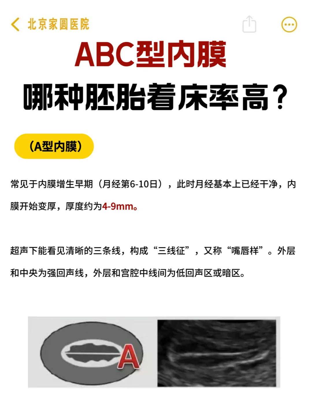 ABC型内膜哪种胚胎着床率高？
