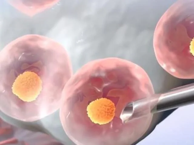 毕生难忘的取卵体验～