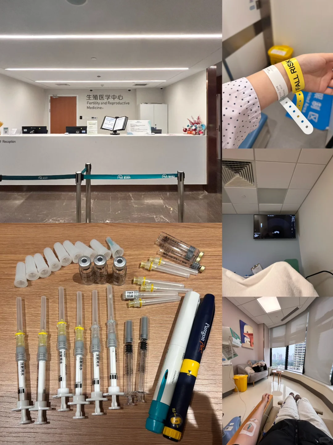 上海嘉会试管日记（促排+取卵+养囊）