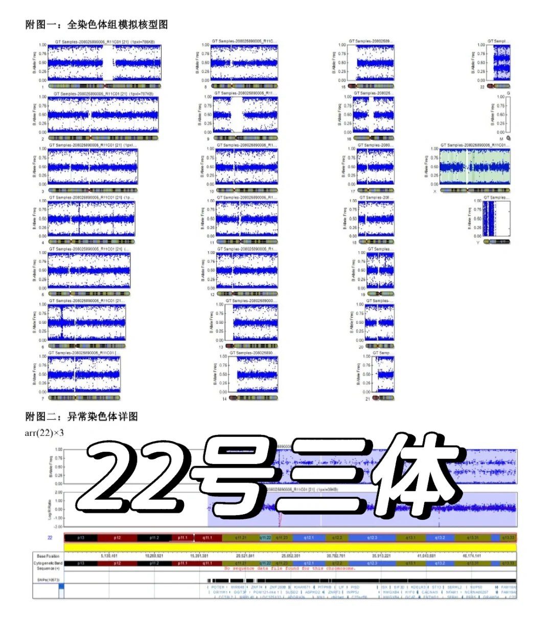 8周胎停 胚染结果出来了,代孕哪里正规-私人试管代孕机构